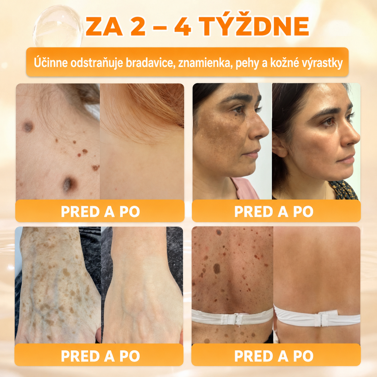 🔥🔥𝗢𝗳𝗶𝗰𝗶á𝗹𝗻𝘆 𝗼𝗯𝗰𝗵𝗼𝗱 • 𝗩𝘆𝗿𝗼𝗯𝗲𝗻é 𝗻𝗮 𝗦𝗹𝗼𝘃𝗲𝗻𝘀𝗸𝘂🍀𝗗𝐨𝐫𝗺𝐨𝐫𝗻𝗮® 𝗞𝗼𝗺𝗽𝗹𝗲𝘅𝗻ý 𝗸𝗿é𝗺 𝘀 𝘃č𝗲𝗹í𝗺 𝗷𝗲𝗱𝗼𝗺🌟𝐏𝐎𝐒𝐋𝐄𝐃𝐍Ý 𝐃𝐄Ň – 𝟖𝟎 % 𝐙Ľ𝐀𝐕𝐀